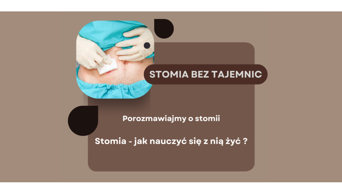 Stomia - jak nauczyć się z nią żyć?